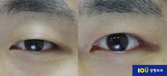 파일:Iousample01.jpg